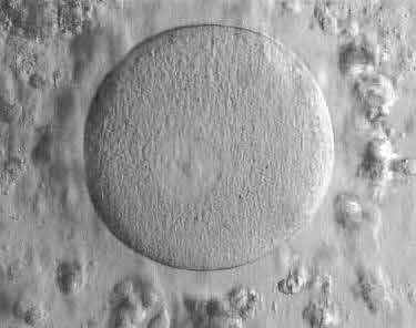 Germinal vesicle stage IVF egg