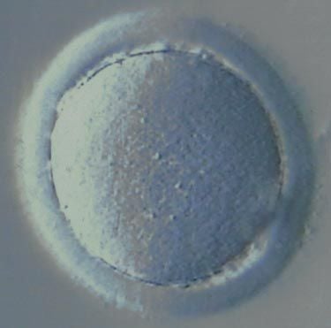 Metaphase I immature egg from IVF