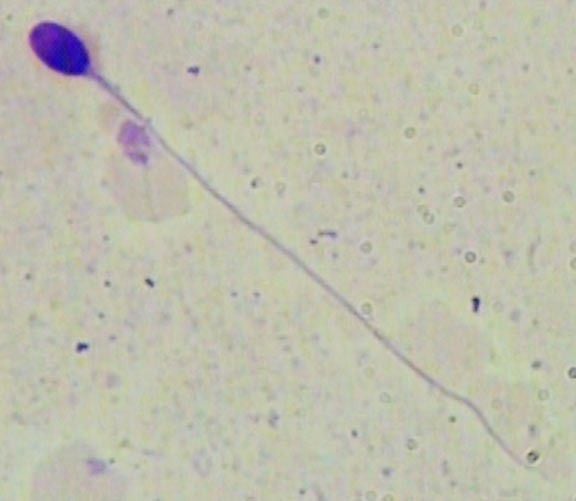 Normal sperm morphology picture