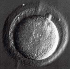 One cell human embryo from IVF