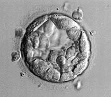 Blastocyst of high quality grade 4AA for IVF