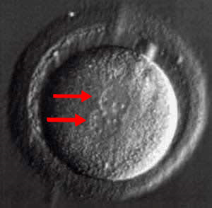 fertilization of egg